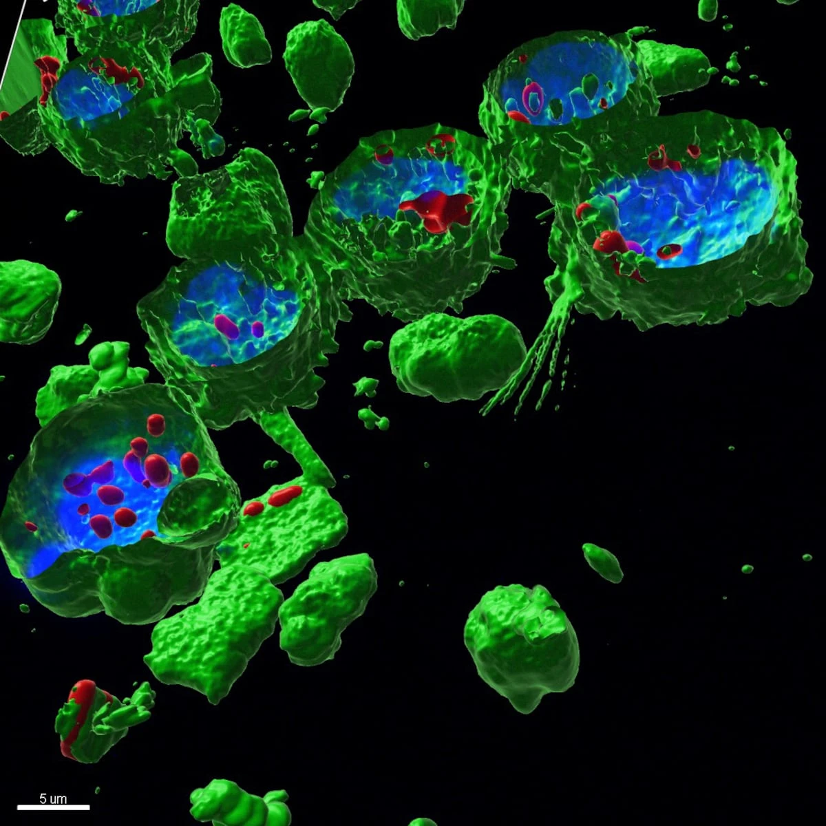 La enigmática huella de los microplásticos en la salud: “Se desconocen los efectos a largo plazo”