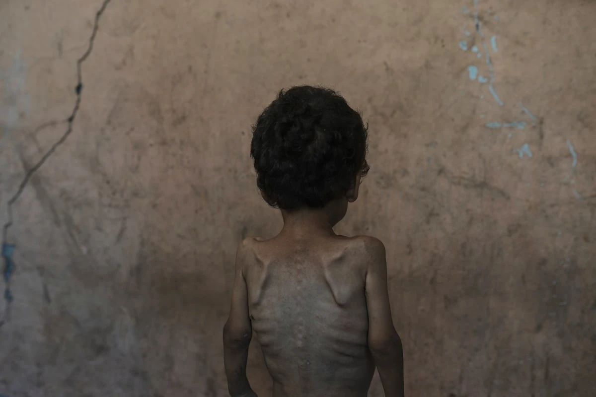 Gaza se muere de inanición: “¿Por qué nos están matando de hambre?”