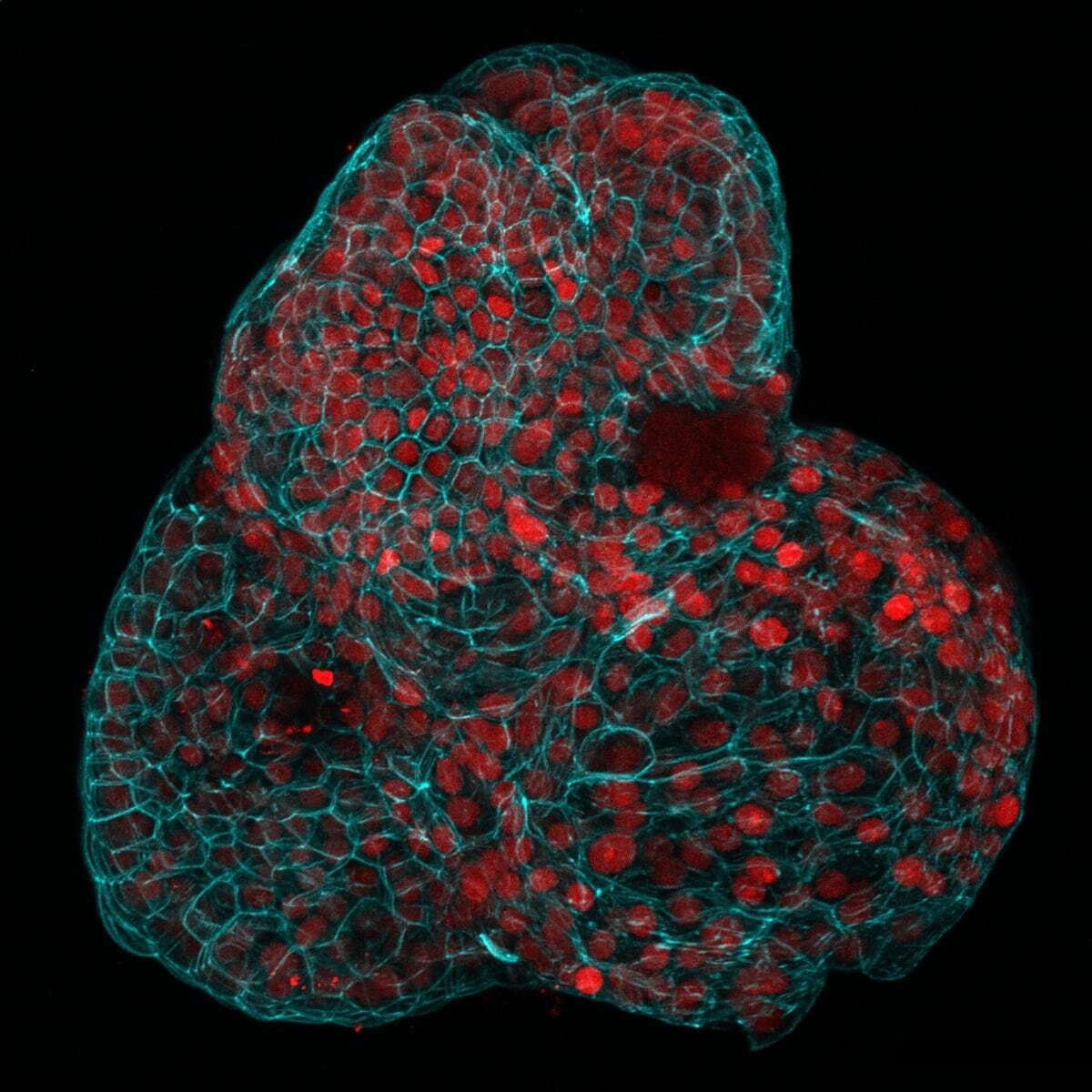 Miniórganos humanos creados con células fetales permiten tratar enfermedades antes de nacer