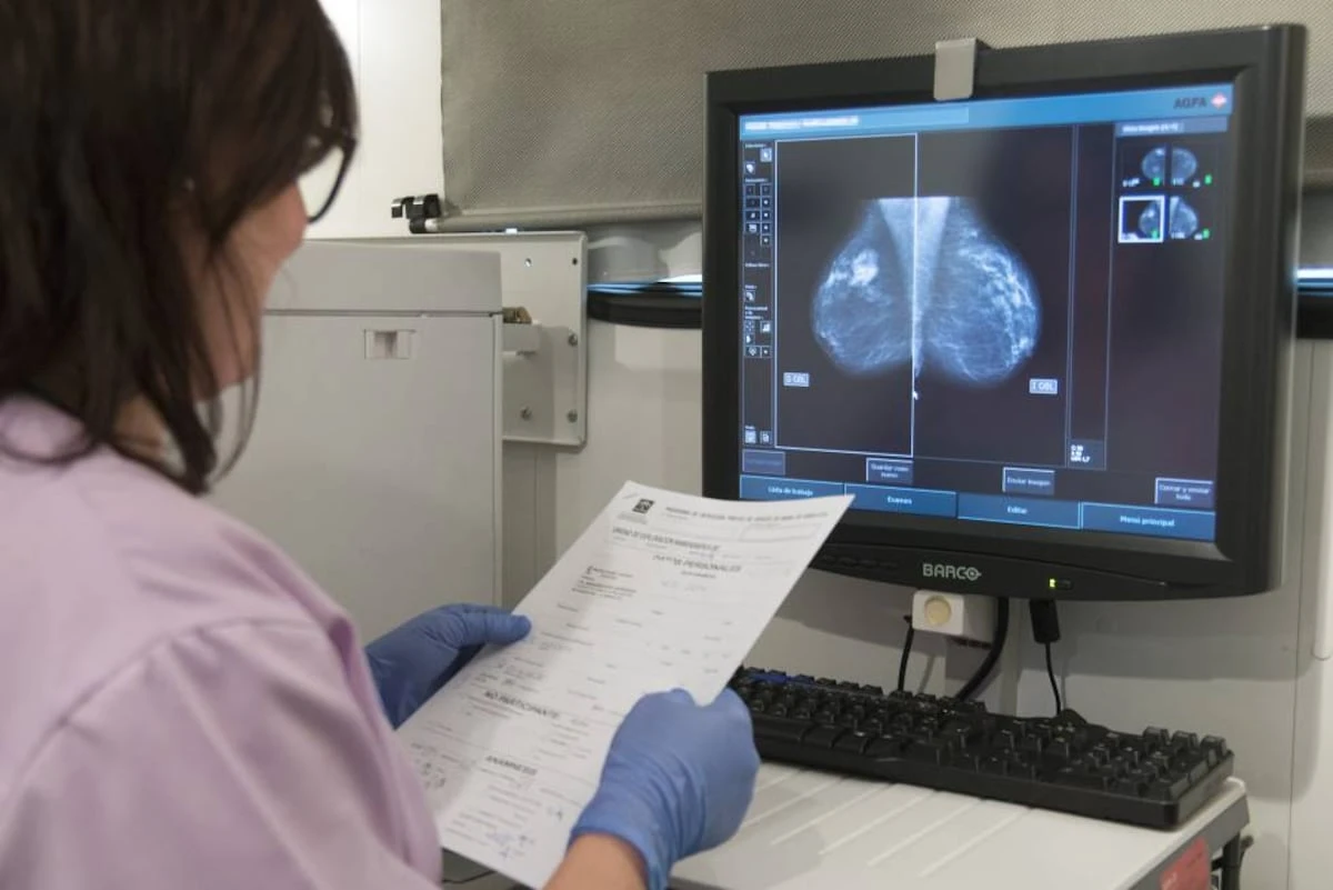 Un ensayo pionero alumbra alternativas de detección precoz del cáncer de mama cuando la mamografía se hace insuficiente