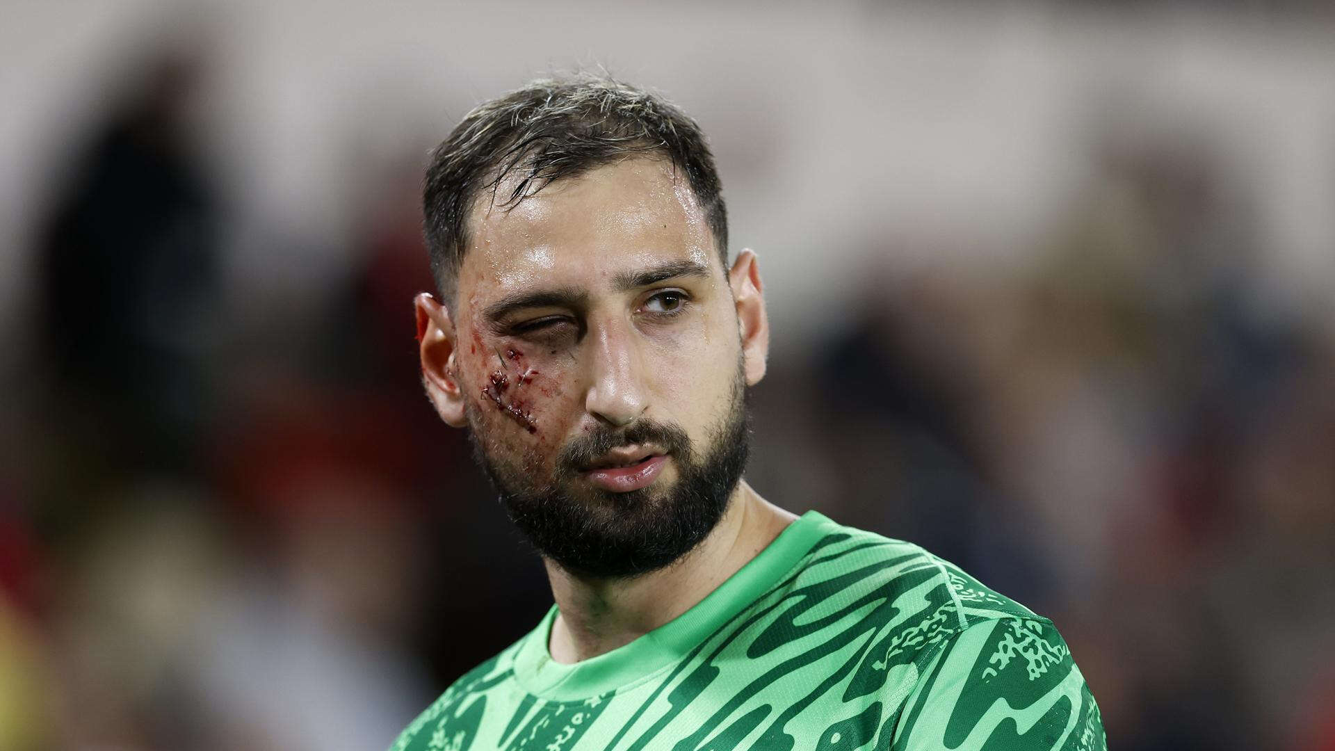 Donnarumma recibe un salvaje pisotón durante el Mónaco-PSG