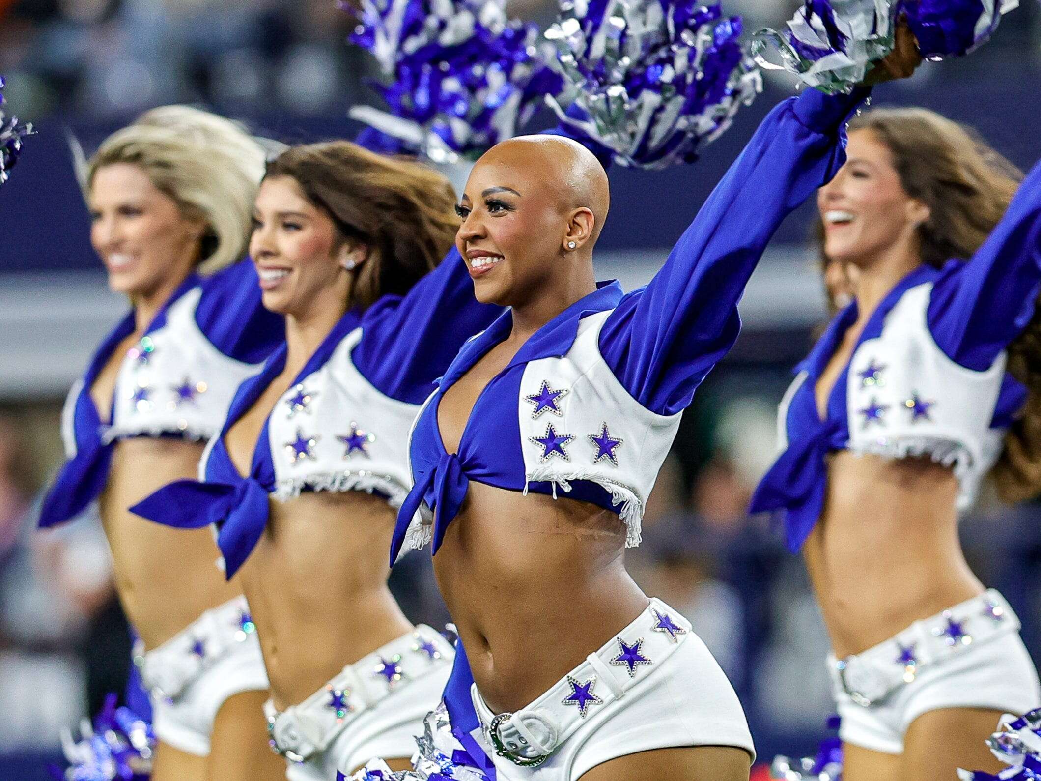 I'm a Dallas Cowboys Cheerleader with alopecia. Performing without a wig for the first time was nerve-racking and liberating.