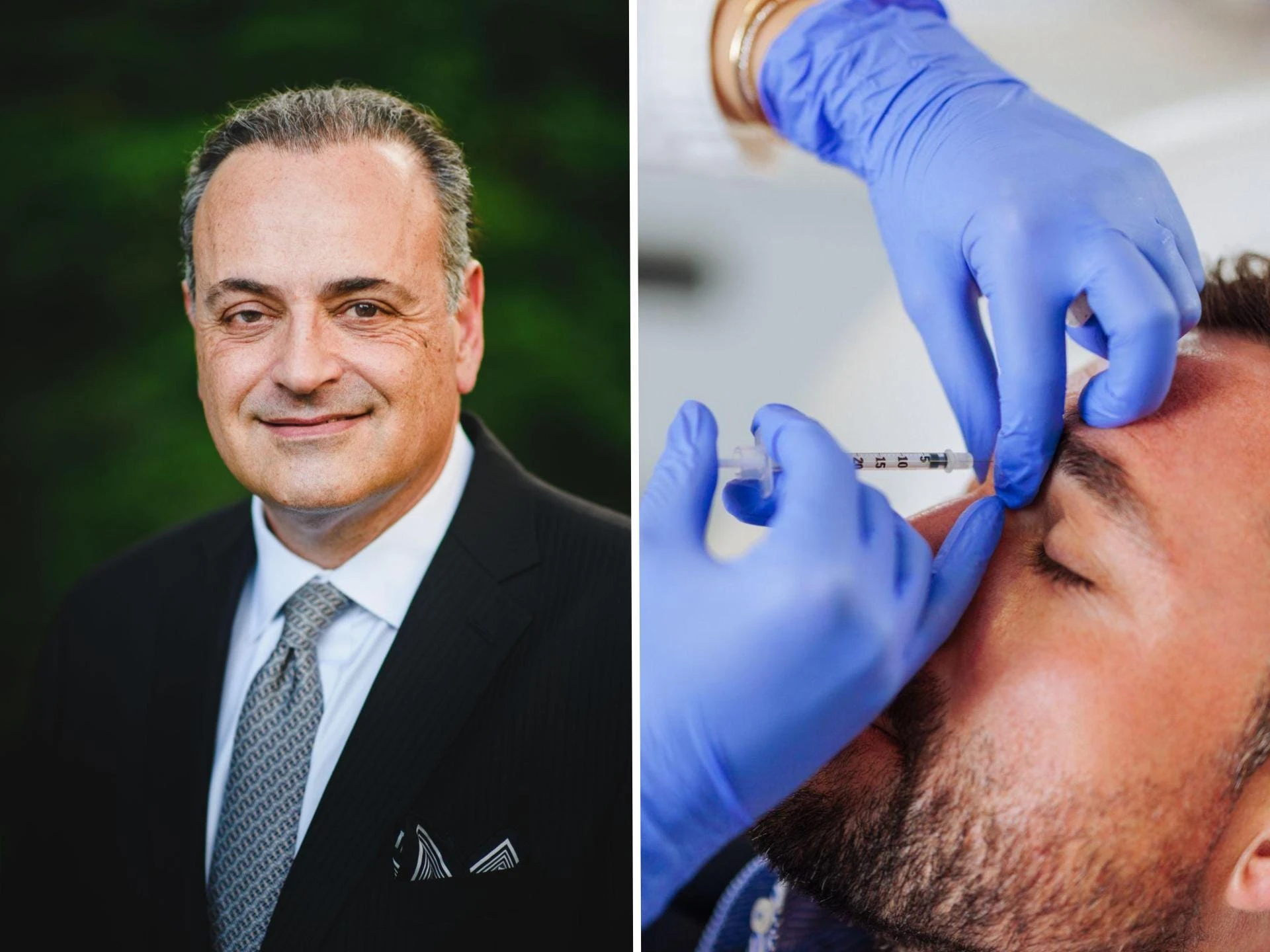 Men are getting quiet glow-ups. A plastic surgeon shares the 5 most popular male cosmetic procedures.
