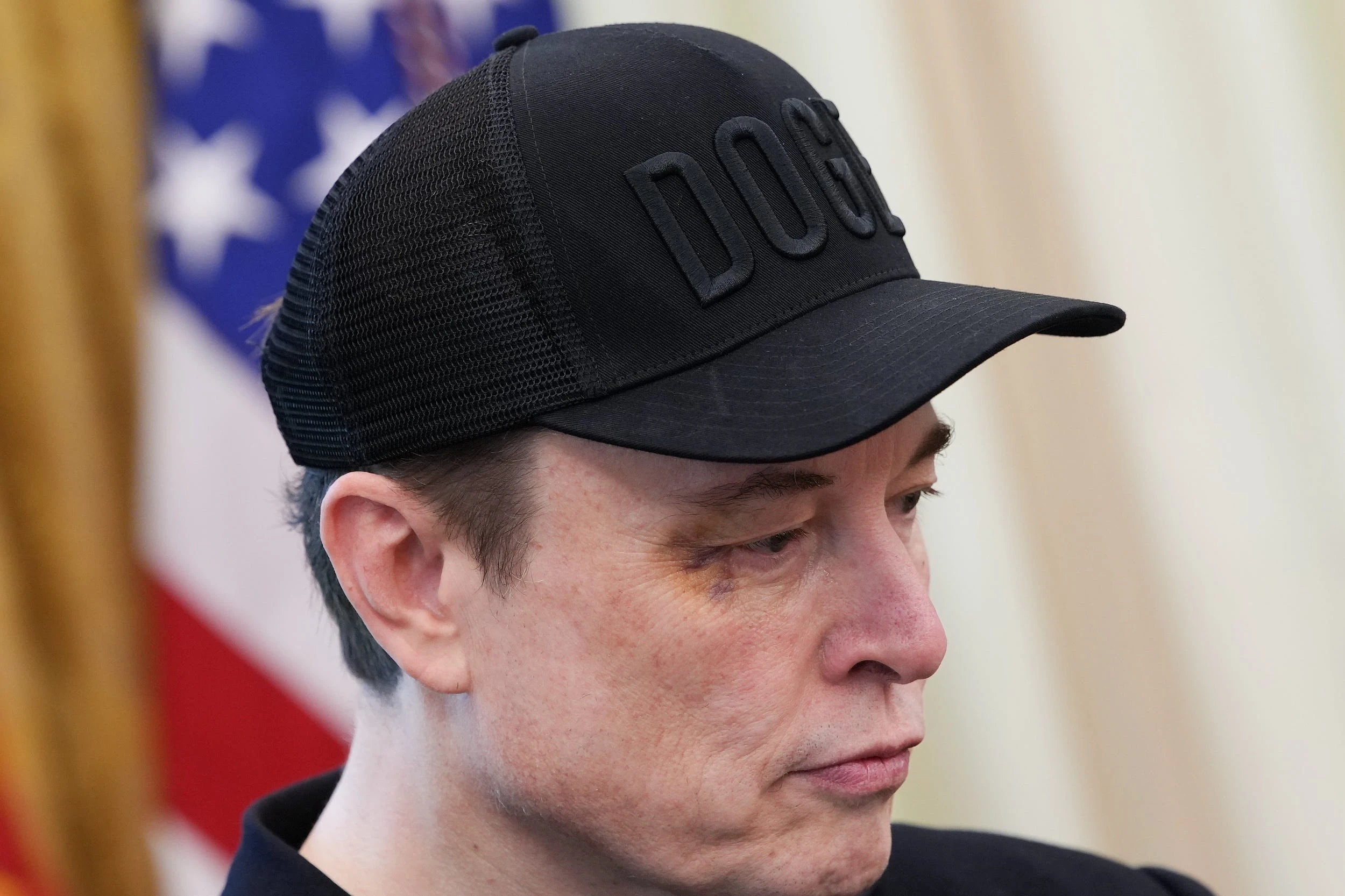 What happened to Elon Musk's eye? The Tesla CEO said the bruise came from 'horsing around'