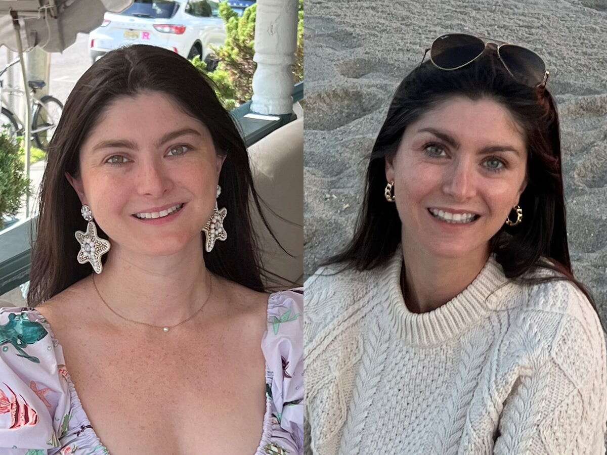 I've been sober for 2 years. My face is less puffy and I get compliments on my glowy skin all the time.