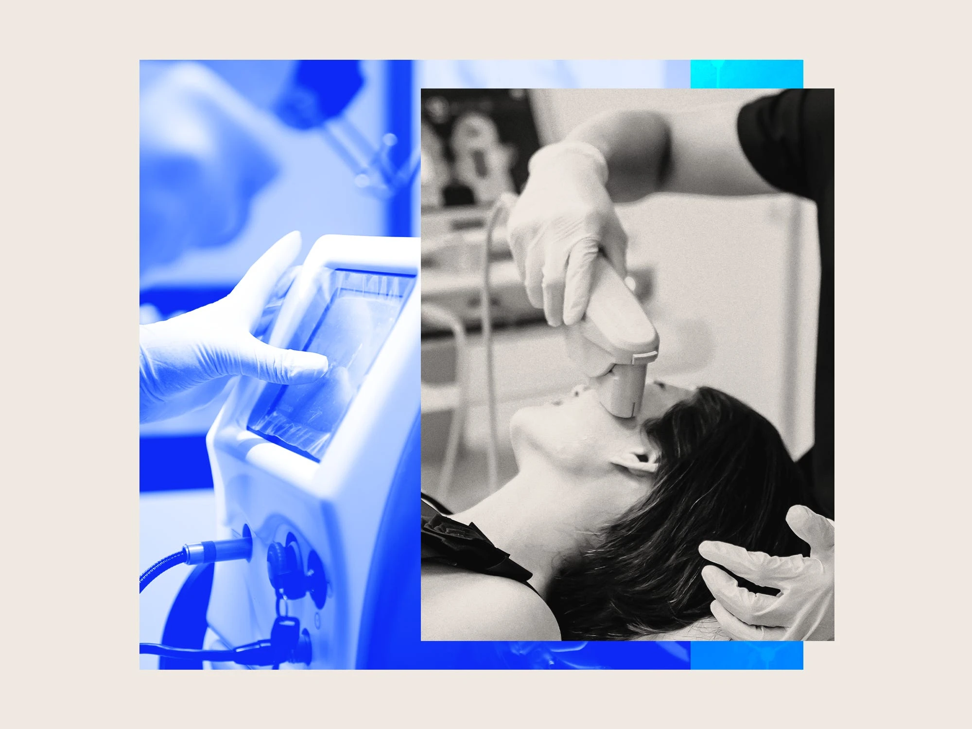 Skin tightening is getting more advanced — and less painful. Here are the new techniques replacing facelifts.