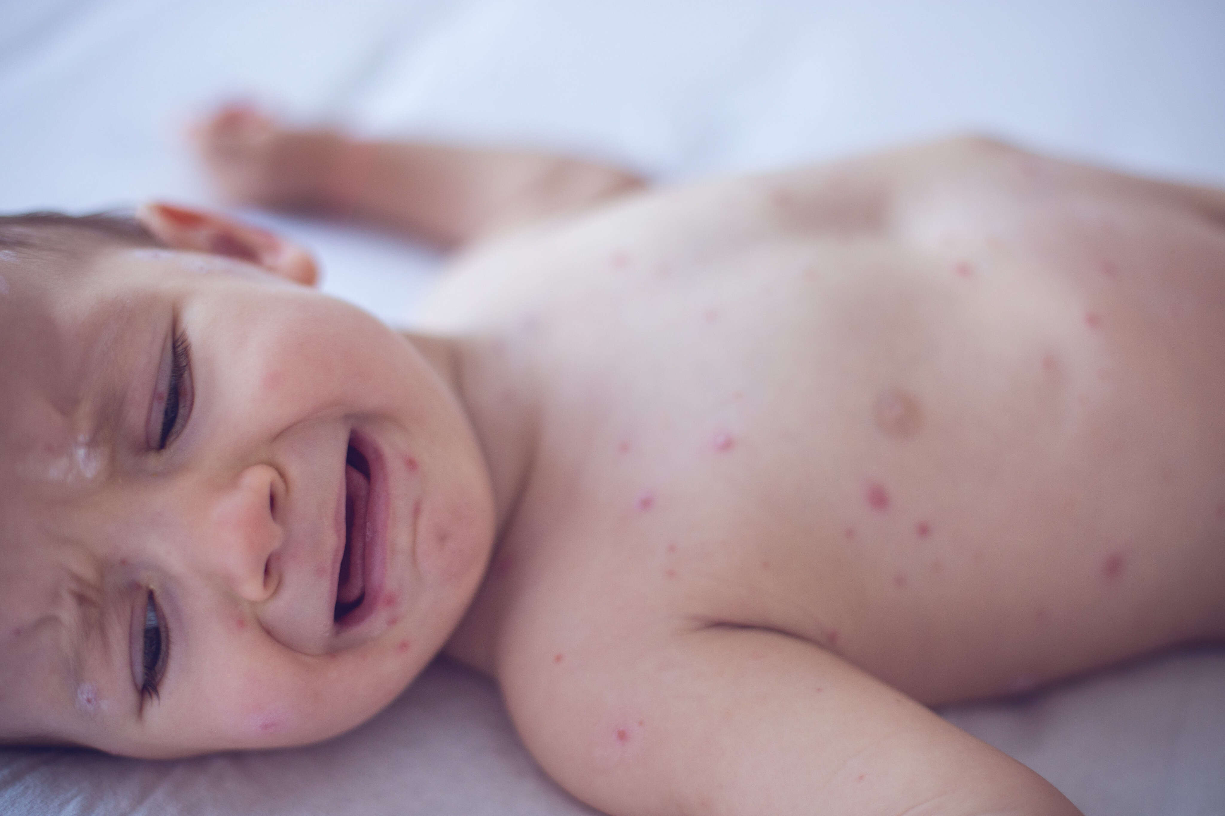 I'm a pediatrician working in the middle of Texas's measles outbreak. Here's what I want parents to know.