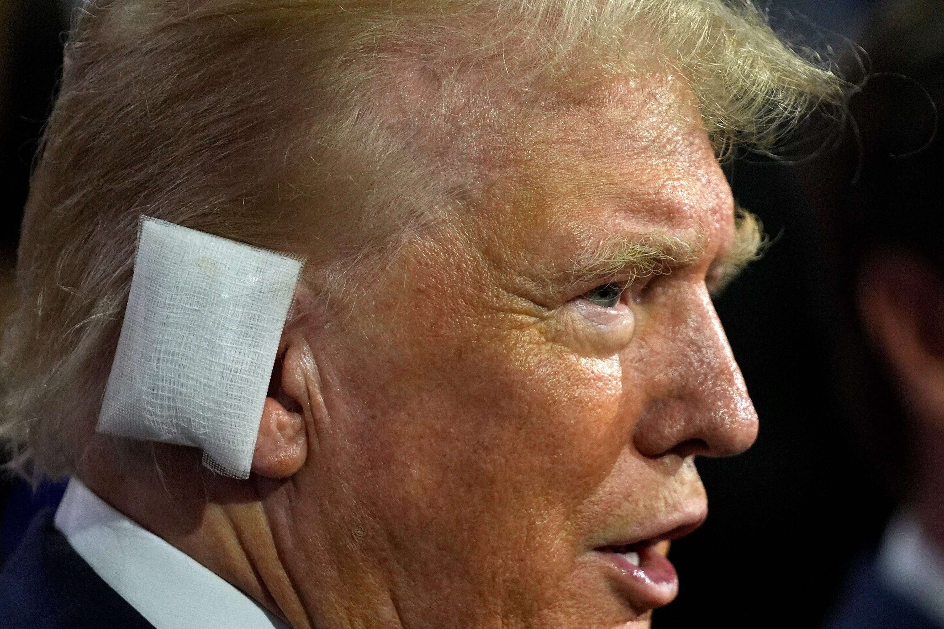 Trump is back out in the spotlight for the first time after his assassination attempt, and he's wearing a massive rectangular bandage over his ear