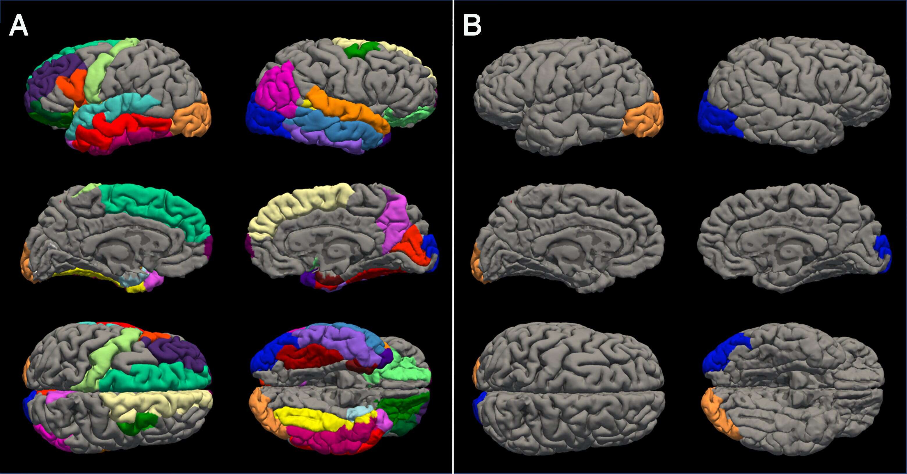 Brain scans show teen girls aged 4 years faster than boys during COVID lockdowns. We asked the researcher what that means long-term.