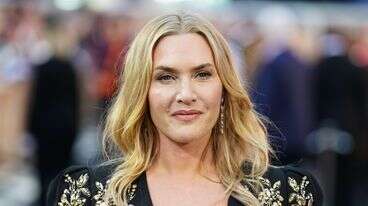 Kate Winslet Has Frank 4-Word Message About Women Showing Their Bodies On Camera