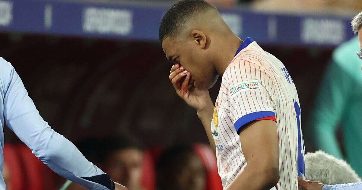 VIDEO: Mbappé se fractura la nariz durante partido de Eurocopa 2024