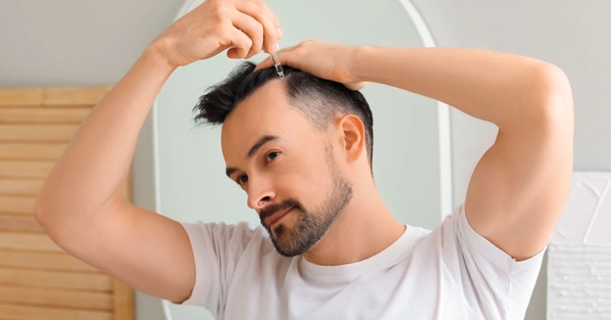Hablemos de la 'calvicie masculina': causas, cómo tratarla y sentirte mejor