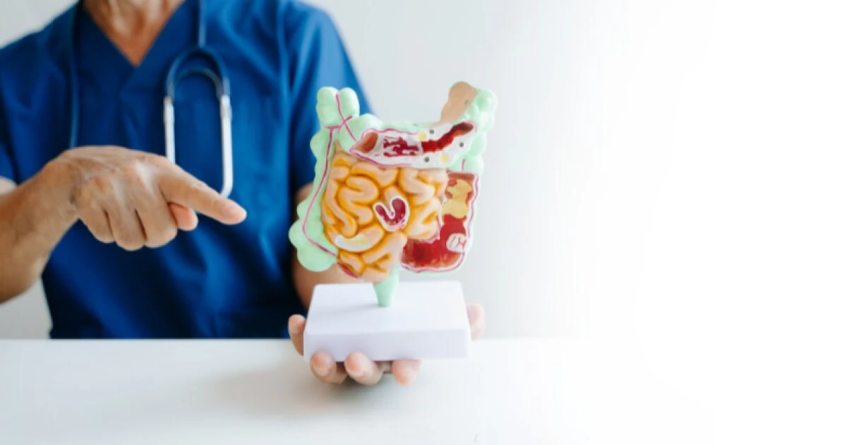 Cómo cuidar tu flora intestinal (sin complicarte la vida)
