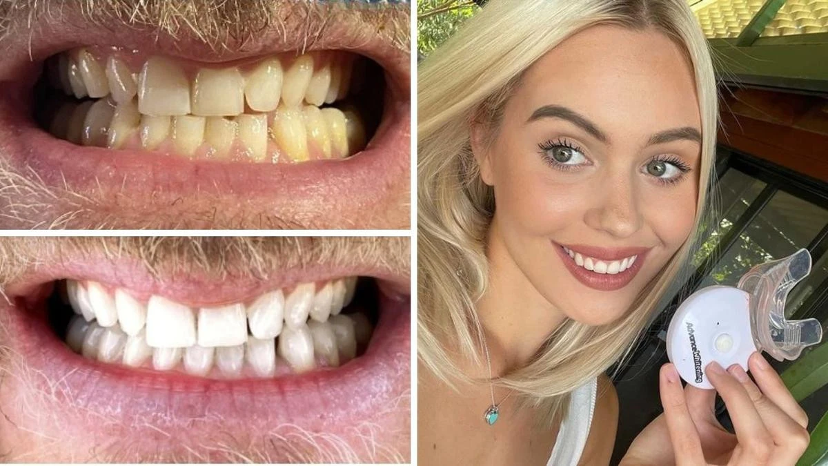 This 10-minute teeth whitening kit with more than 800 reviews has hit its lowest price ever