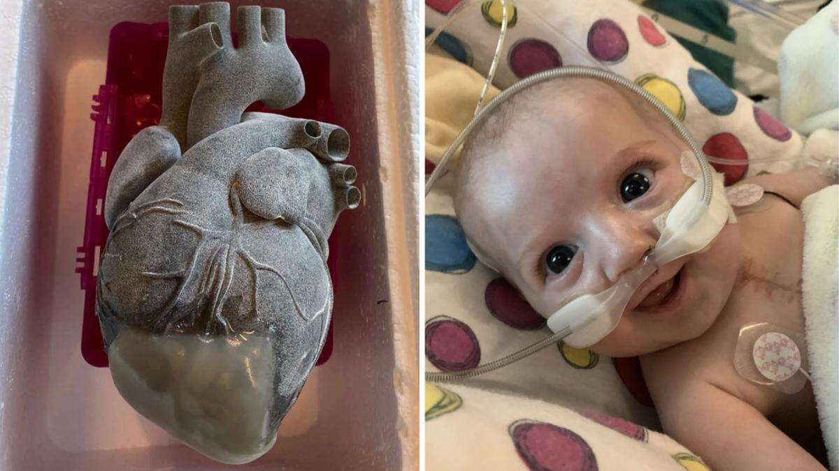 ‘Mini hearts’: New research could help save little girl’s heart