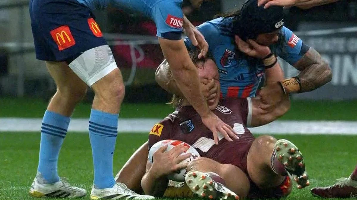 Surprise twist emerges in Origin eye-gouge incident