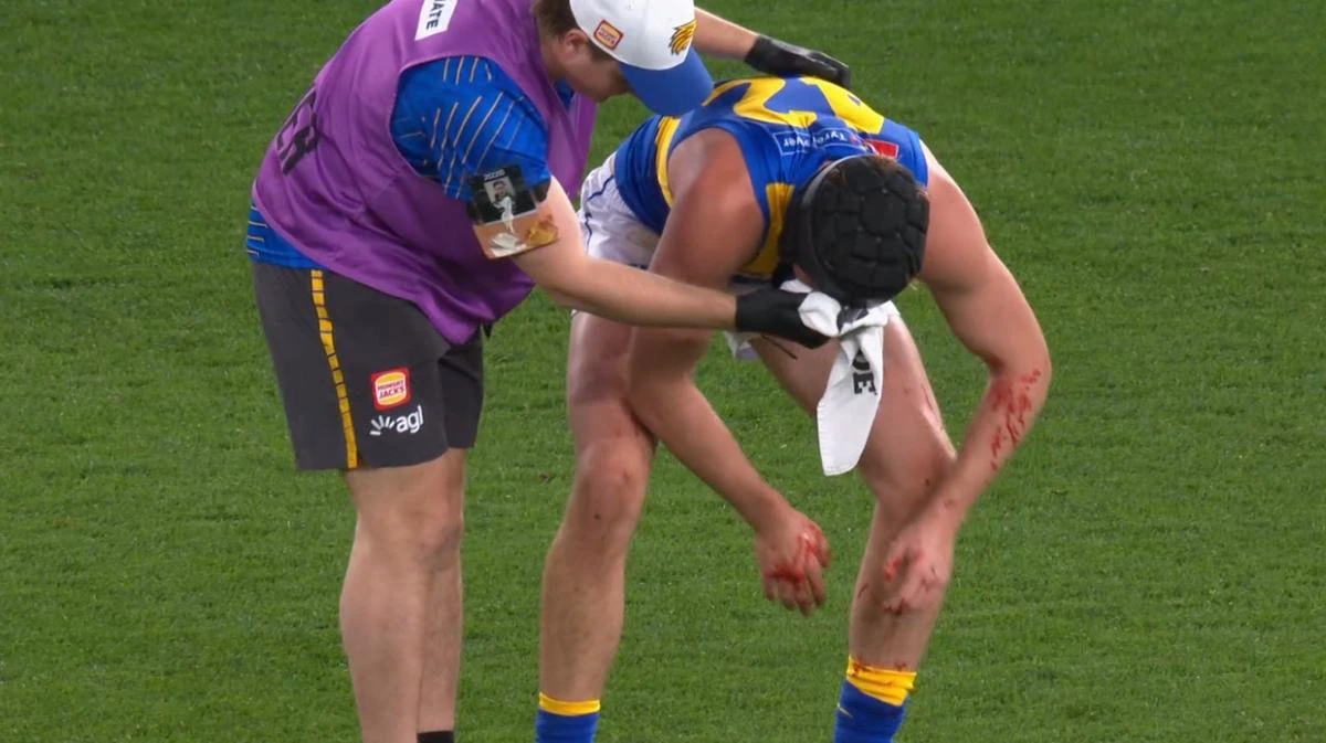 Luckless West Coast defender split open in first game back