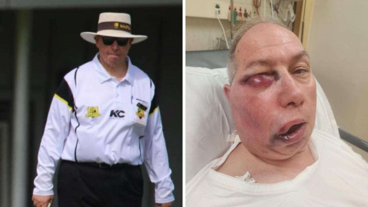 Senior cricket umpire sent to hospital after ‘brutal blow’ during match