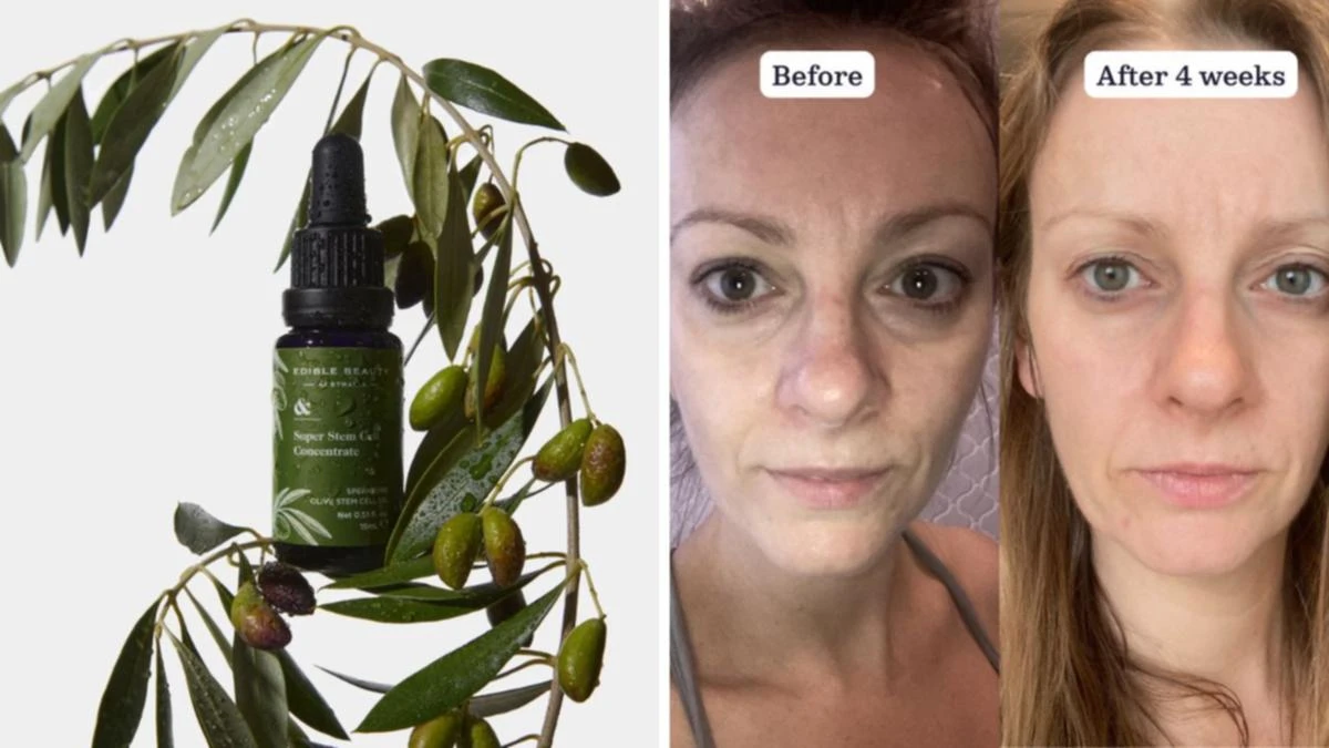 ‘I tried the Aussie serum with 5000 five-star reviews and my skin’s never looked better’