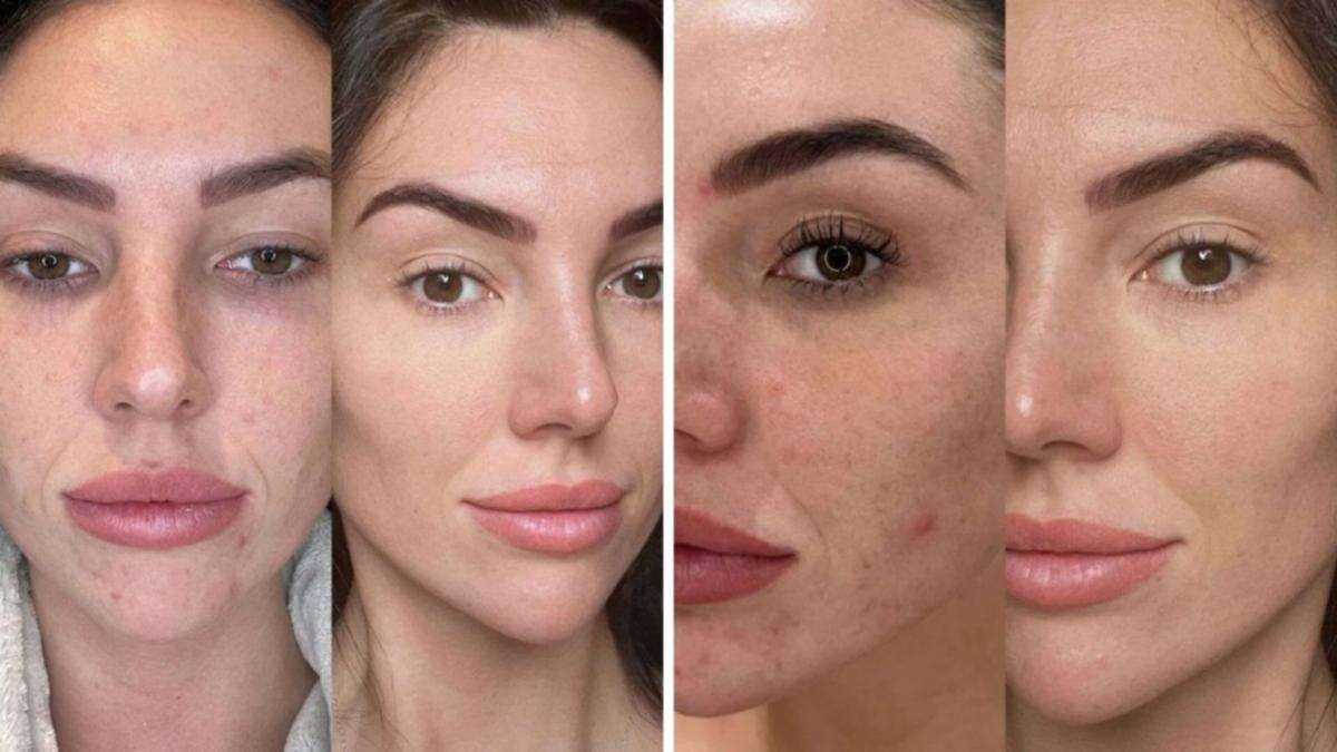 The skincare routine that is transforming Aussie faces: ‘I can’t recommend these products enough’