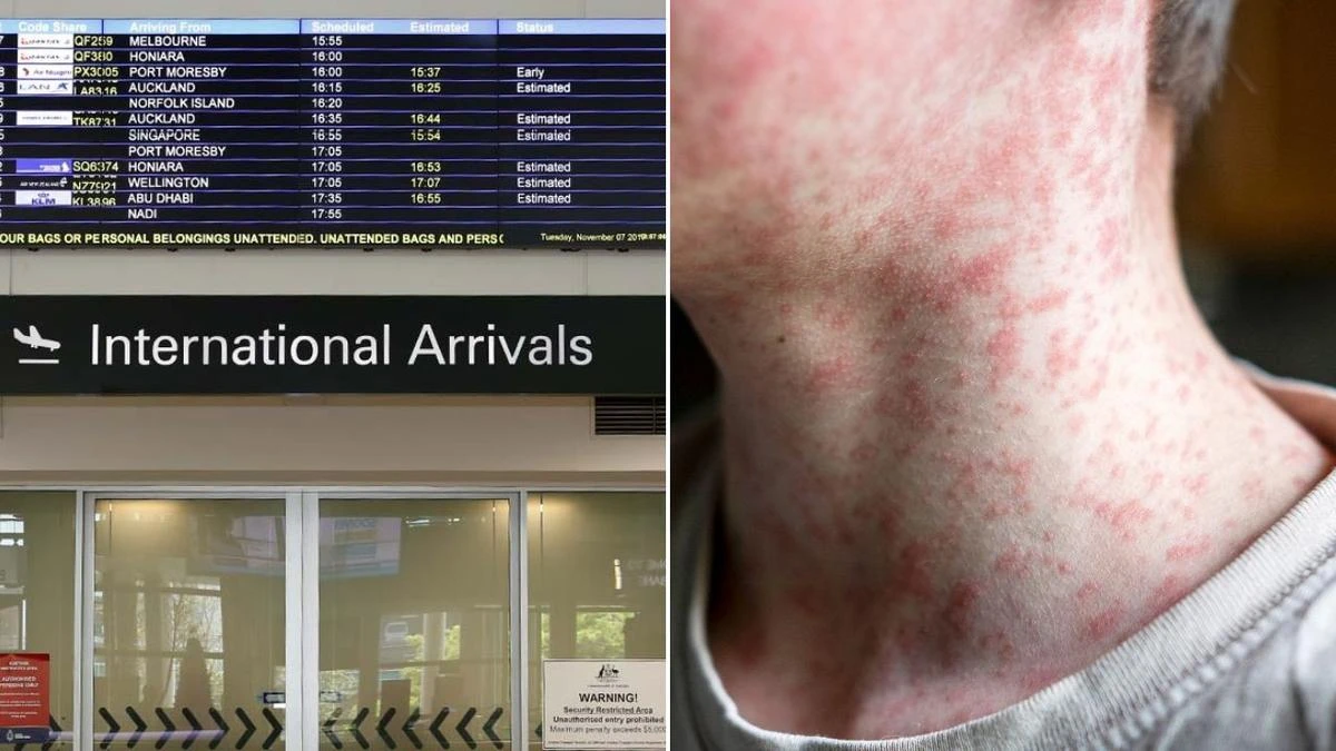 Health warning as measles cases pass through major international Aussie airport