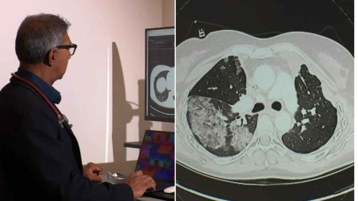 The aggressive ‘new cancer’ killing young Australians