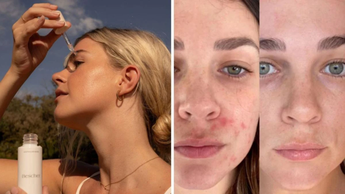 Aussies rushing to buy eye cream that ‘banishes dark circles’