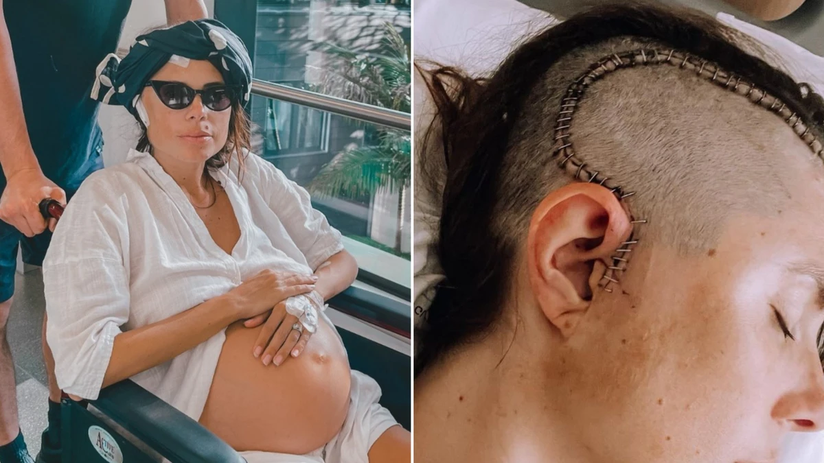 ‘Take this seriously’: Young mum’s plea after severe headache led to cancer diagnosis