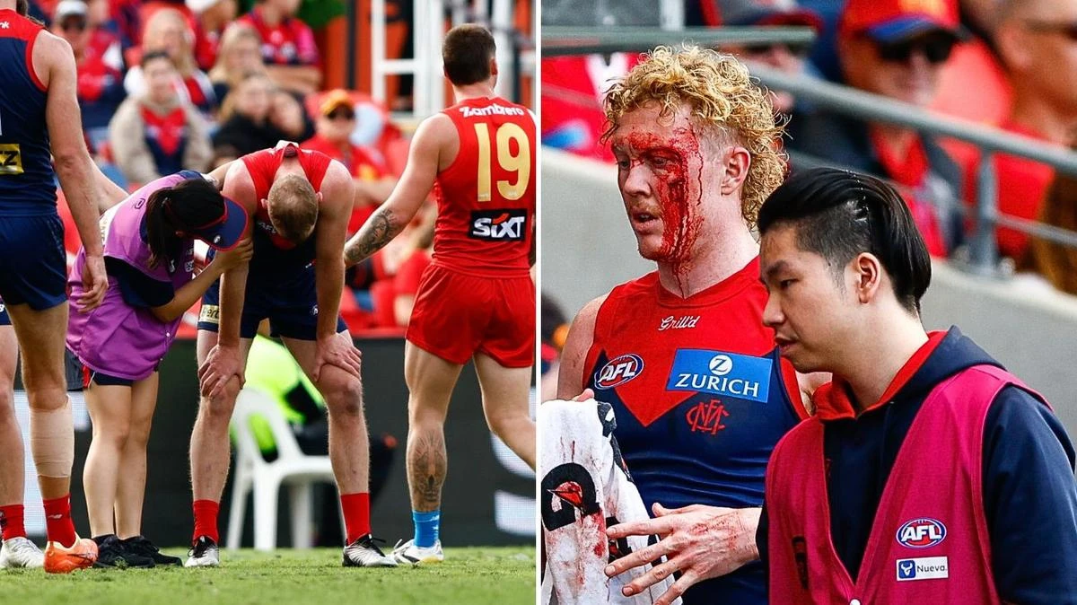 Mass carnage as stars get wiped out in bruising encounter