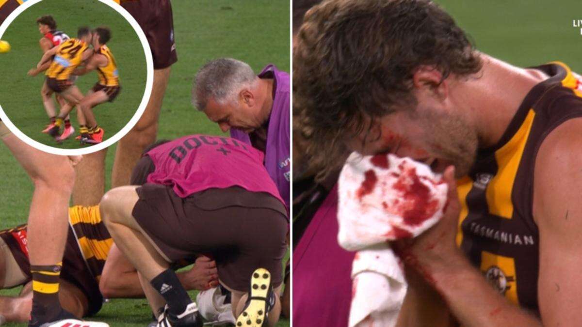 Hawthorn defender taken off with blood pouring from his face