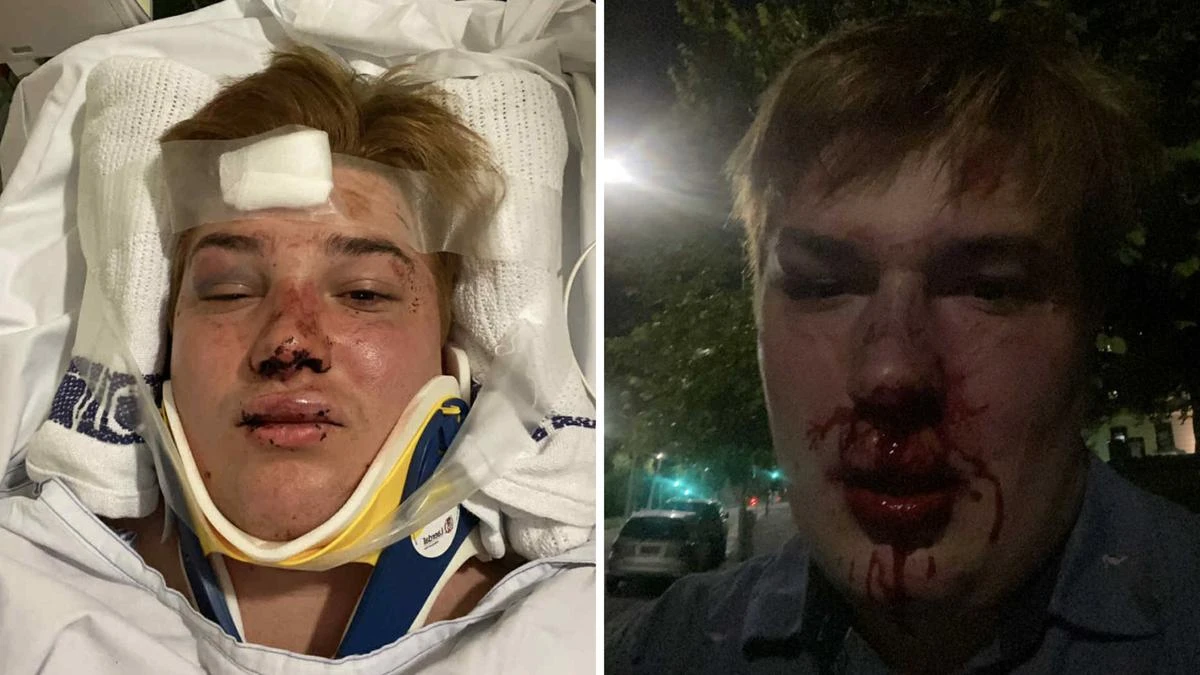 Jack thought he was going on a date. Instead, he was viciously bashed by eight kids in an Aussie park