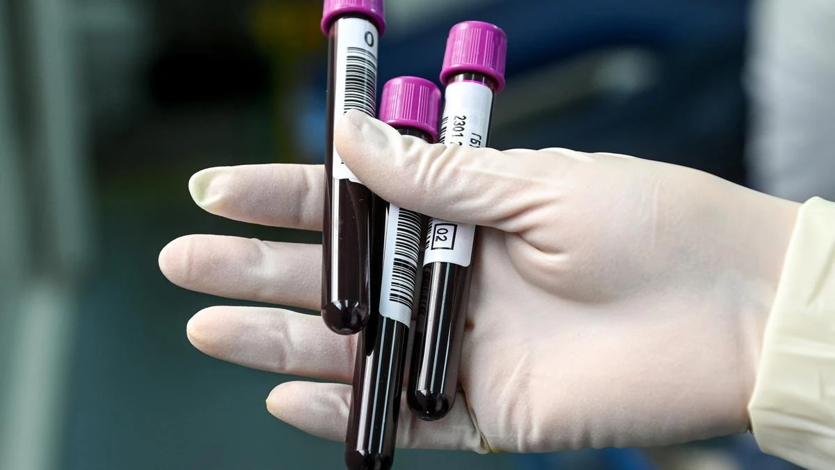 Patients potentially exposed to blood-borne viruses at Sydney dentist