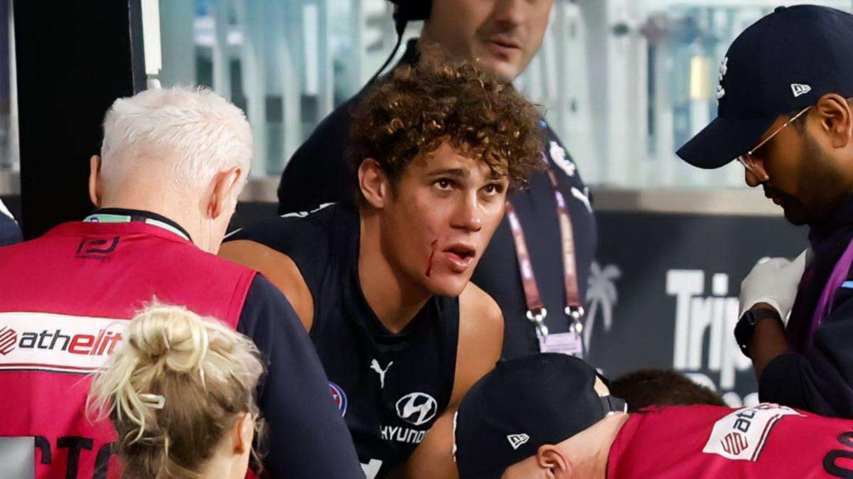 Injury scare sends shockwaves through Carlton camp