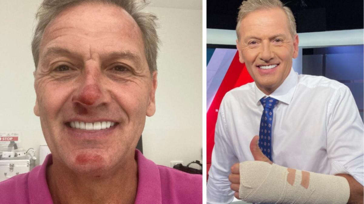 7NEWS presenter shares ‘embarrassing’ new detail of bike crash