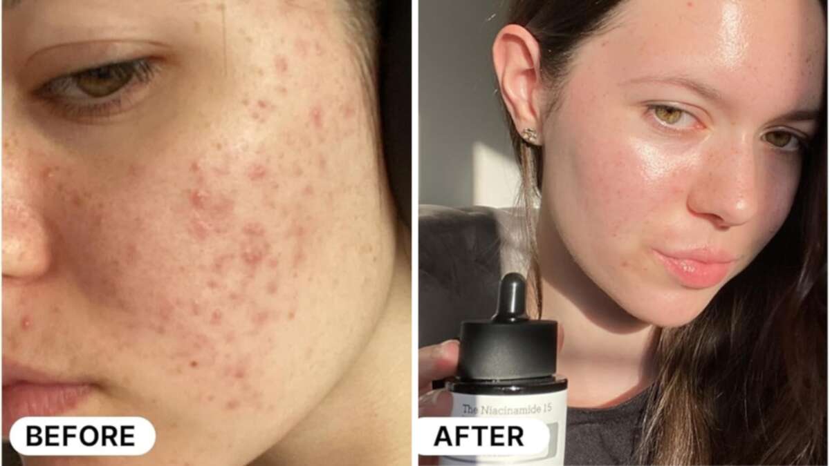 ‘Snail mucin’ brand drops the price of popular serum to less than $20