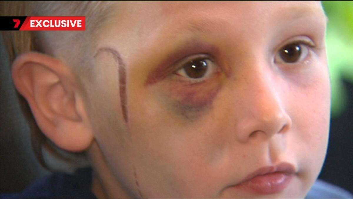 ‘He wasn’t moving’: Parents’ outrage after son, 5, brutally attacked with golf club