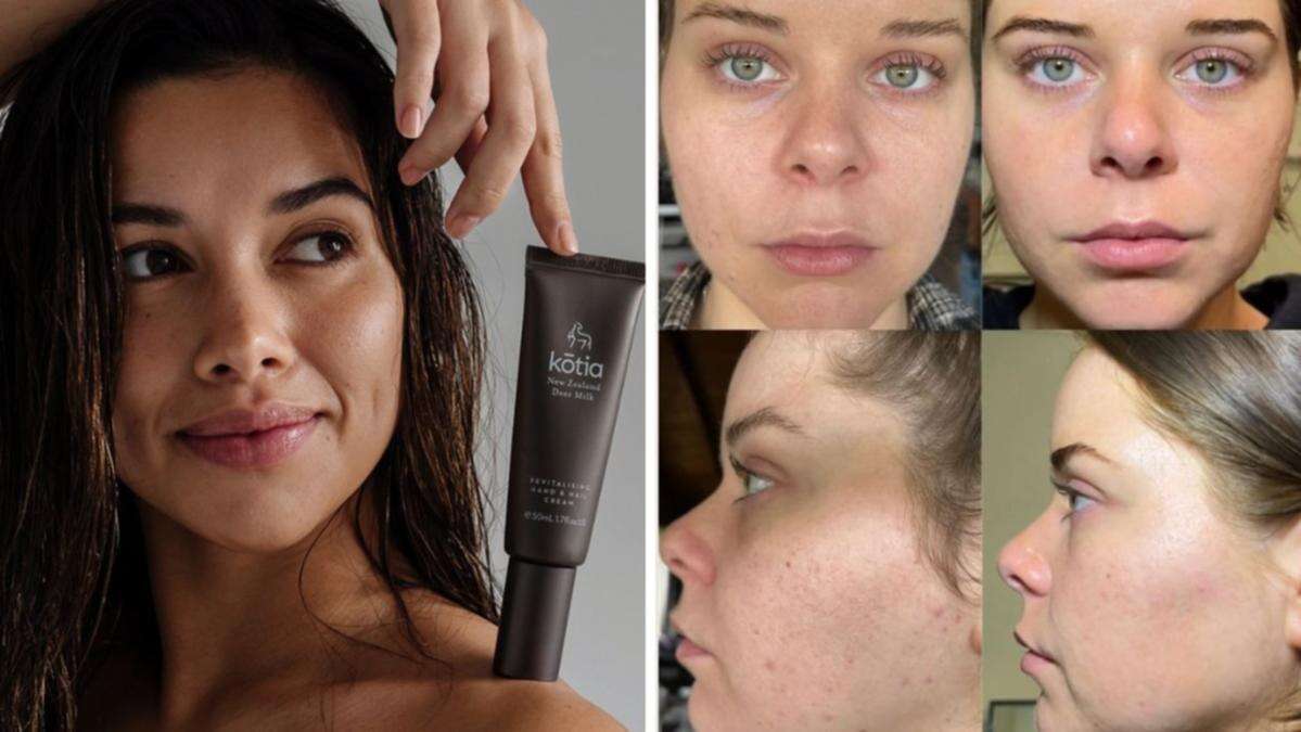 Women showcase dramatic results using skincare made from unique ingredient