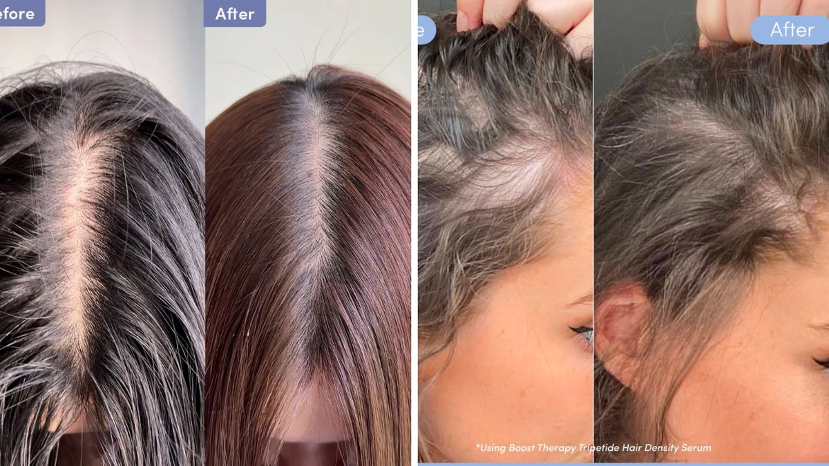 Clinically proven hair loss serum with ‘game-changing’ results finally goes on sale