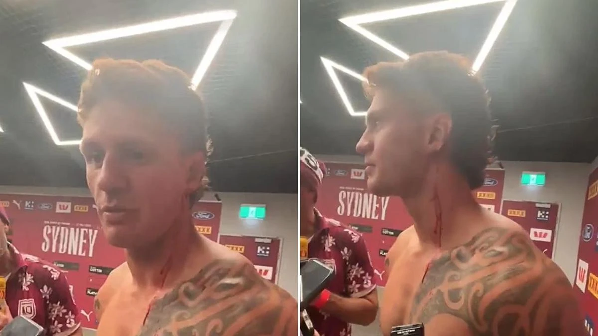 Kalyn Ponga makes raw admission with blood dripping from his ear