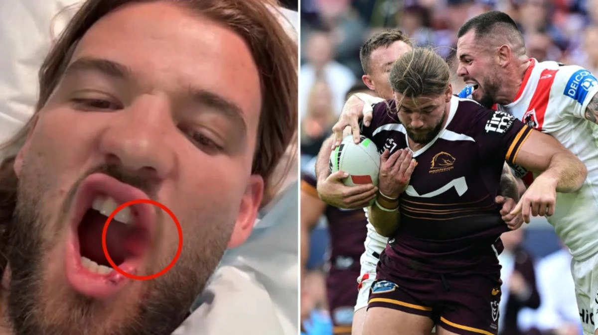 Origin selection thrown into disarray after gruesome mouth injury