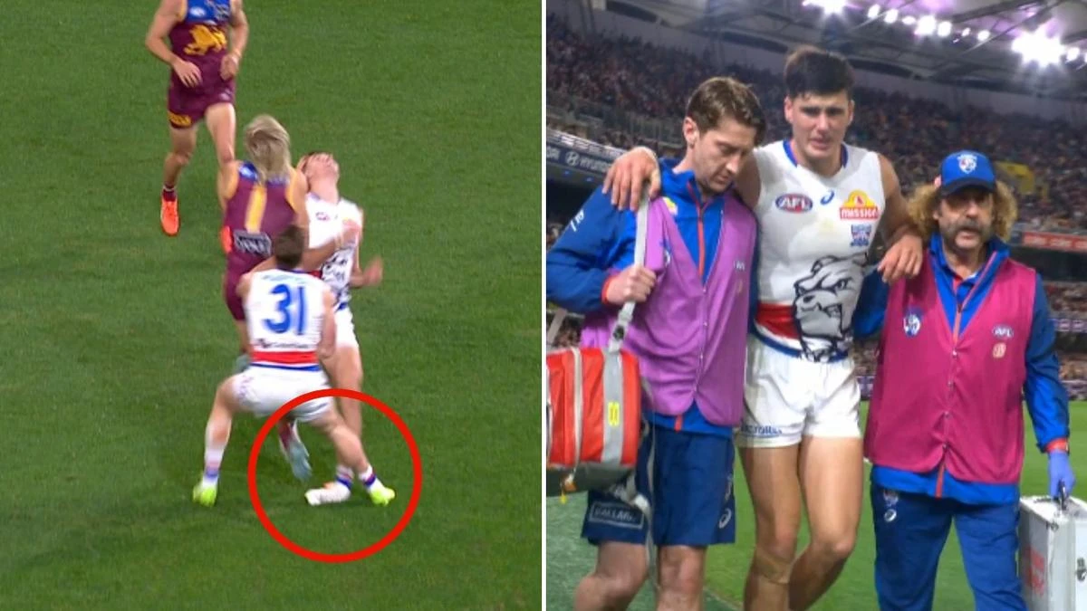 Bulldogs defender suffers sickening ankle injury in dying minutes