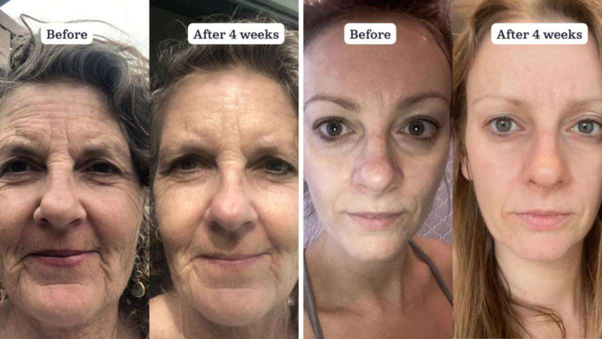 This anti-ageing serum is delivering dramatic results for Aussie women