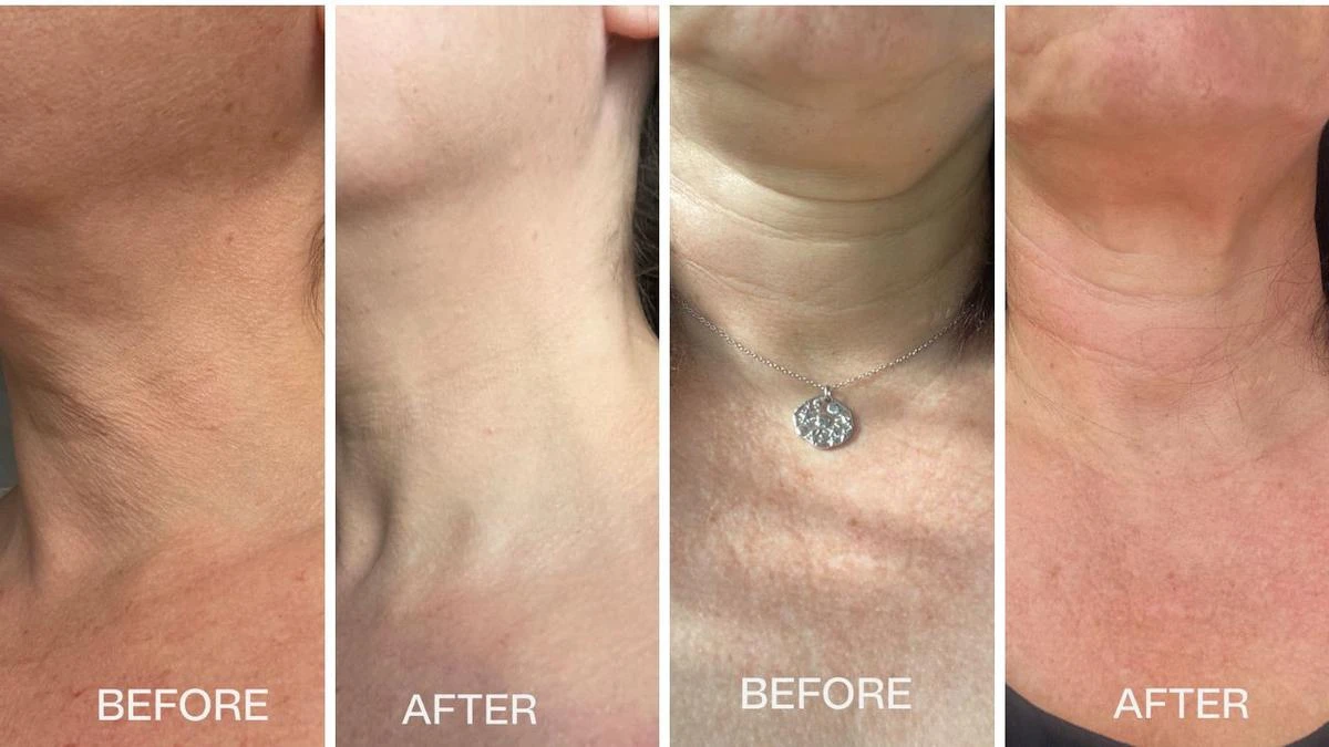 The $40 best-selling neck serum shoppers love: ‘One is selling every 10 minutes’