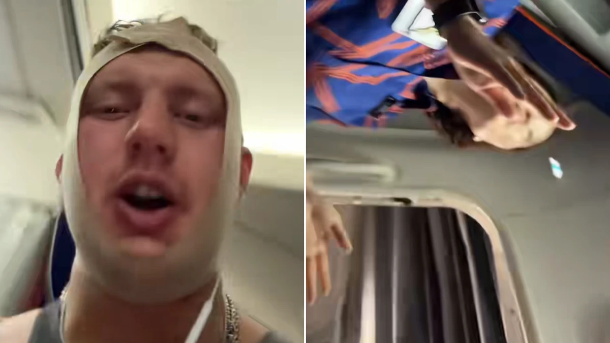 Aussie ‘looksmaxxer’ kicked off Jetstar flight after cosmetic surgery