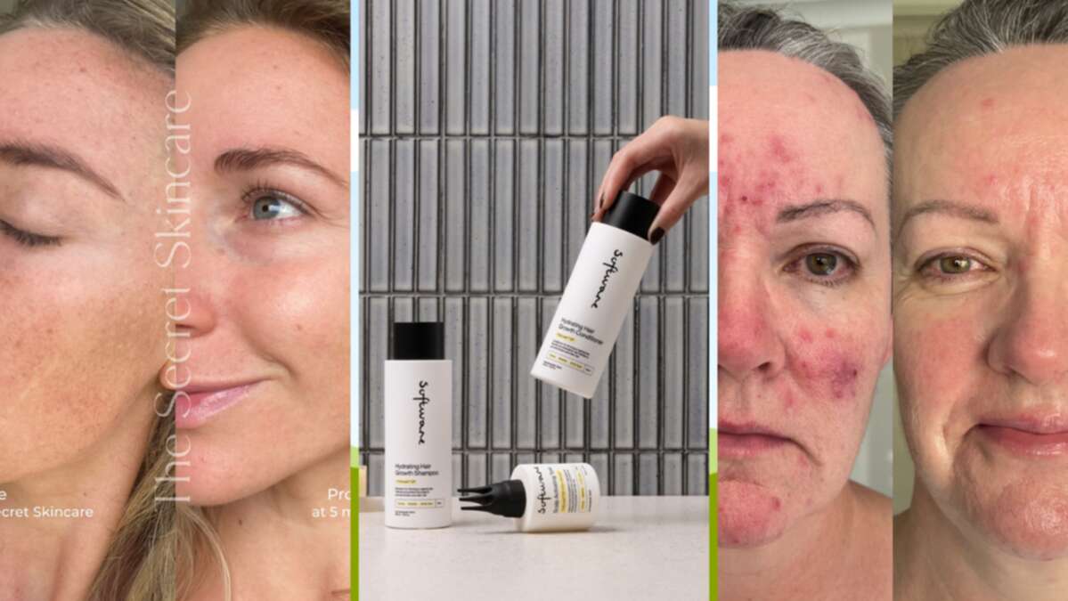 Thousands of Aussies claim personalised skincare cleared up acne and rosacea