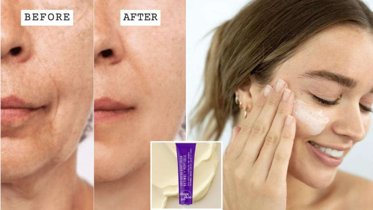 ‘Life-changing’ retinol sells out in 24 hours and it’s just $59.95