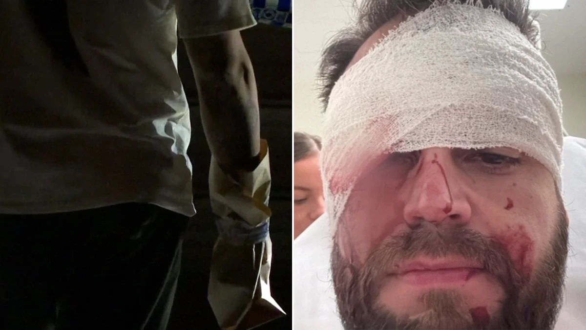 Grim details emerge after man allegedly slashed in face