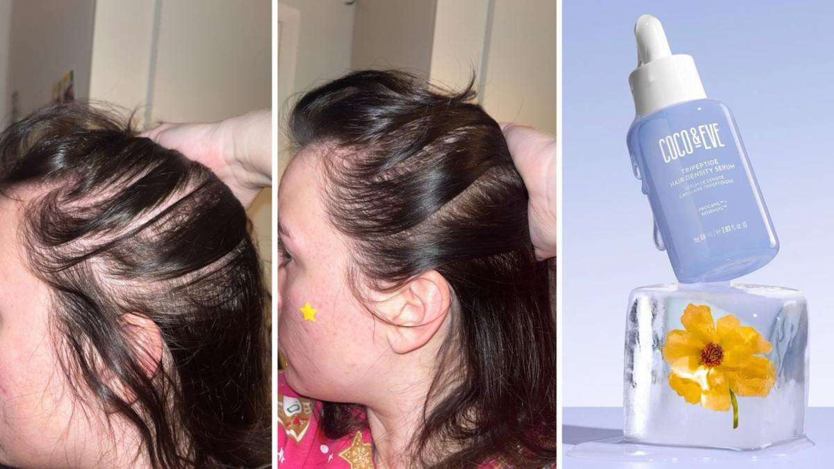 Clinically tested serum to help with hair growth becomes a fan favourite: ‘This is a game-changer’