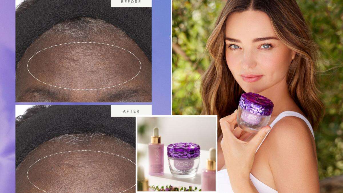 Miranda Kerr’s secret weapon to fighting wrinkles in her 40s: ‘My skin feels nourished and plumped’