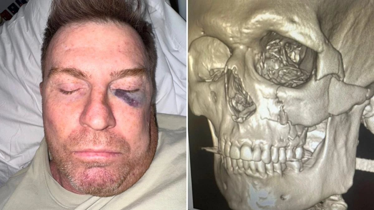 AFL cult hero set for facial surgery after frightening accident